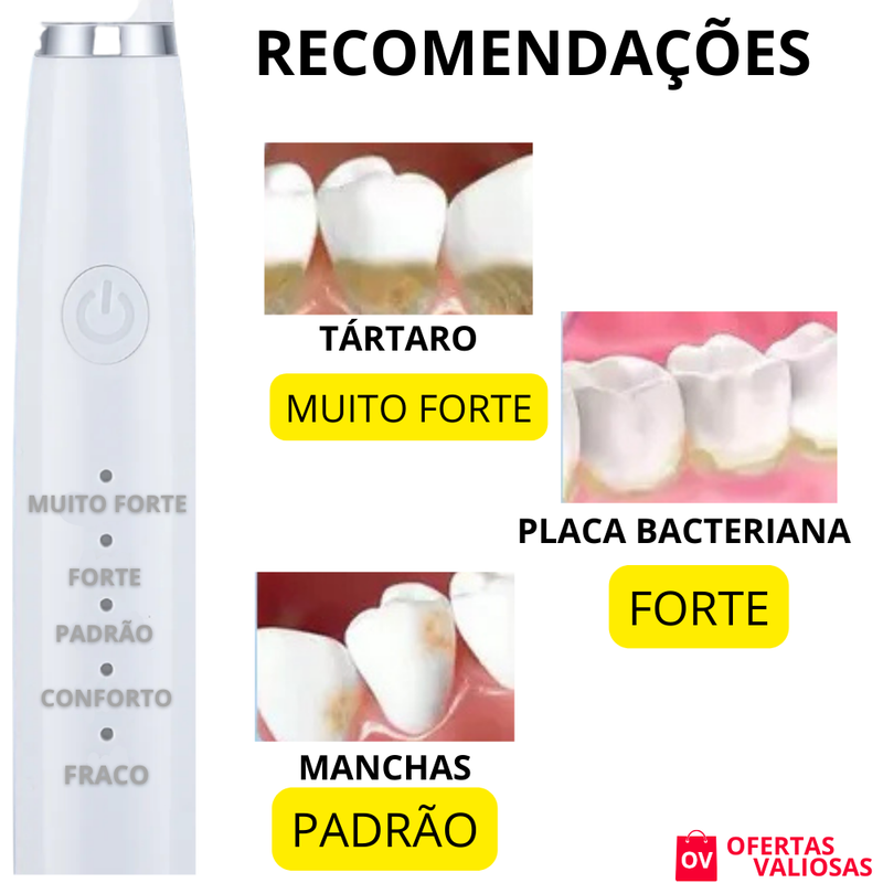 Limpador Dental Sonic©-Removedor de Tartaro, Manchas e Sujeiras Indesejadas